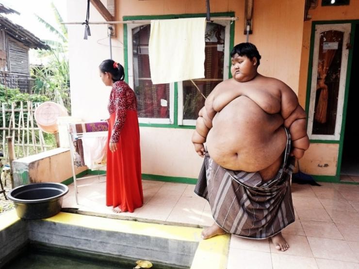Indonesia: Cuộc sống yên bình của cậu bé giảm hơn nửa trọng lượng cơ thể