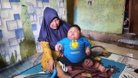 Indonesi: Bé trai 16 tháng nặng 27 kg được hỗ trợ giảm cân
