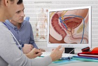 Đã tìm ra phương pháp mới điều trị ung thư tuyến tiền liệt