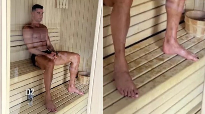 Cristiano Ronaldo gây sốt với việc đăng ảnh sơn móng chân