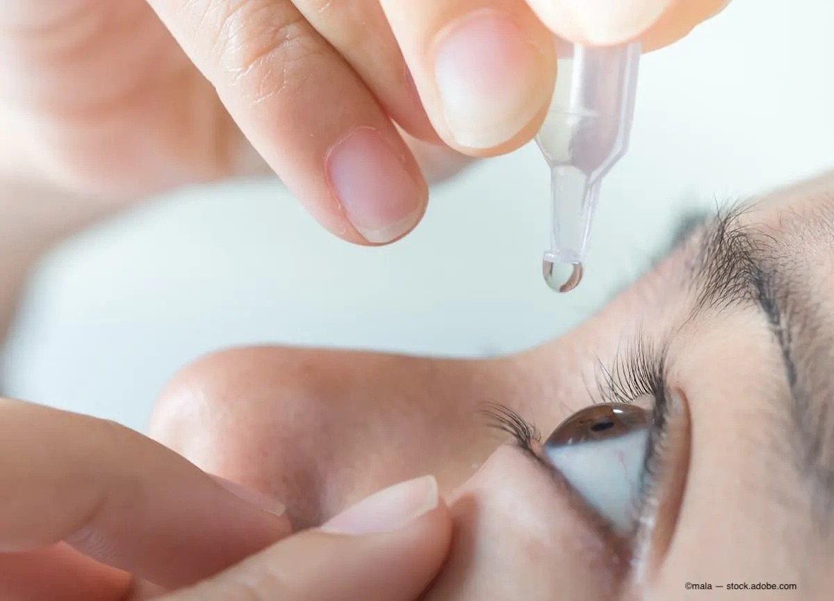 Mỹ bùng phát “dịch” thuốc nhỏ mắt bị nhiễm khuẩn