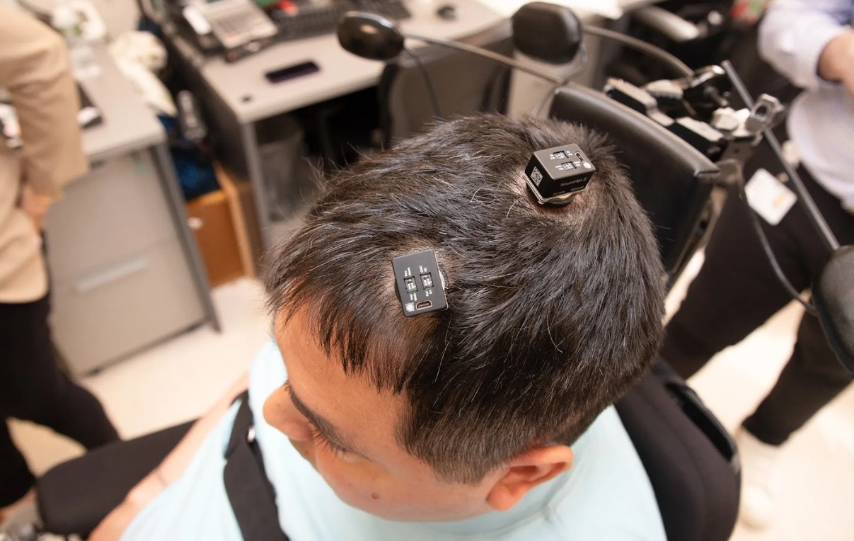 Hình ảnh các bộ khuếch đại tín hiệu trên đầu Thomas (nguồn: Viện Nghiên cứu Y khoa Feinstei)