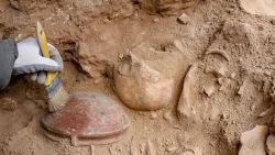 Thổ Nhĩ Kỳ tìm thấy bằng chứng về phẫu thuật sọ não khoảng 3.200 năm trước