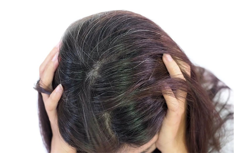 Nguyên nhân 4 vị trí tóc bạc nhiều và gợi ý cách khắc phục