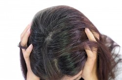 Nguyên nhân 4 vị trí tóc bạc nhiều và gợi ý cách khắc phục