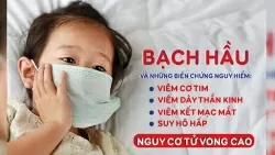 Thủ tướng ra công điện yêu cầu không để lây lan, bùng phát bệnh bạch hầu