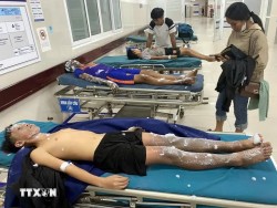 Tự chế pháo nổ, bốn học sinh ở Quảng Bình nhập viện cấp cứu