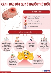 Nguyên nhân và cách phòng ngừa đột quỵ ở người trẻ tuổi