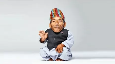 Nepal: Người đàn ông thấp nhỏ nhất thế giới do mắc hội chứng đặc biệt hiếm gặp