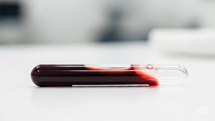 Người phụ nữ duy nhất trên thế giới mang nhóm máu