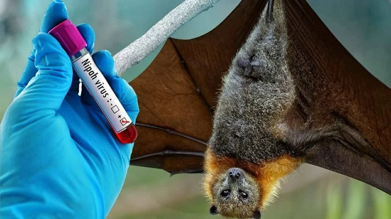 Bộ Y tế hướng dẫn chẩn đoán và điều trị bệnh do virus Nipah