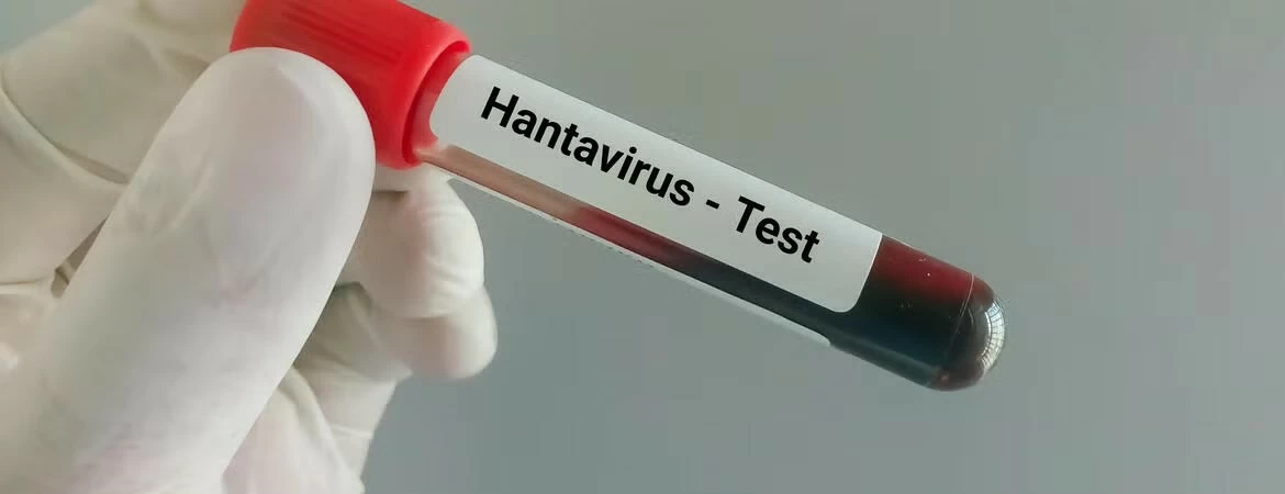 Dịch Hantavirus: Nỗi lo truyền nhiễm toàn cầu