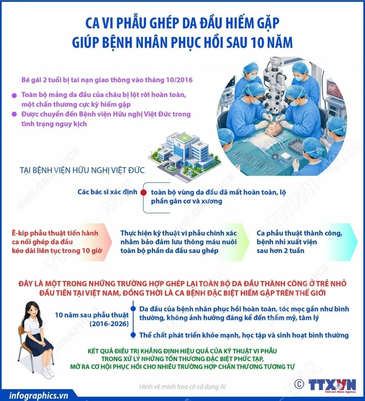 Bé gái hồi phục hoàn toàn sau ca phẫu ghép da đầu hiếm gặp tại Bệnh viện Hữu nghị Việt Đức Bé gái hồi phục hoàn toàn sau ca phẫu ghép da đầu hiếm gặp tại Bệnh viện Hữu nghị Việt Đức