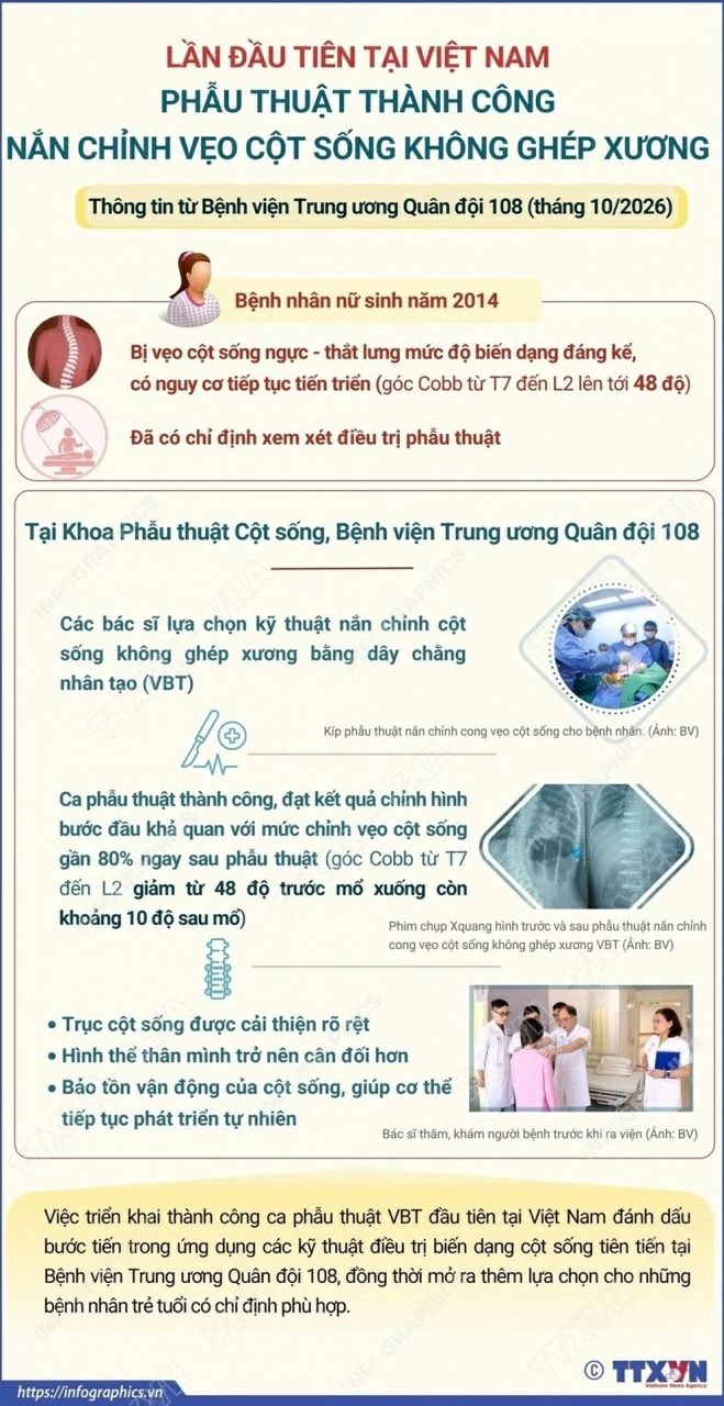 Kỹ thuật mới giúp bệnh nhân vẹo cột sống bảo tồn vận động Kỹ thuật mới giúp bệnh nhân vẹo cột sống bảo tồn vận động