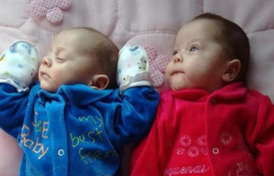 Cặp song sinh chào đời từ người mẹ chết não hơn 4 tháng