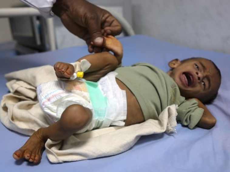 ​Hàng triệu trẻ em trở thành nạn nhân của xung đột vũ trang tại Yemen