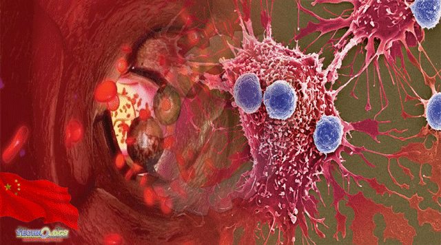 Phát hiện 'thủ phạm' khiến tế bào ung thư di căn. (Nguồn: technology Times)