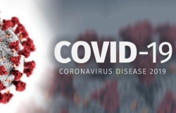 Covid-19: Nhật Bản và hàng loạt nước có số ca nhiễm mới tăng cao, quan chức Nga đầu tiên tiêm vaccine