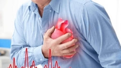 Hai tuần đầu sau khi khỏi Covid-19: Nguy cơ nhồi máu cơ tim, đột quỵ tăng gấp 3 lần