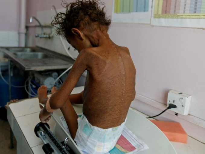 L​iên hợp quốc kêu gọi cứu trợ 8,4 triệu người ở Yemen