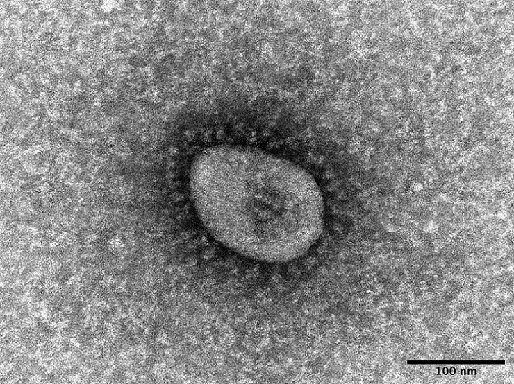 Biến thể omicron của virus gây bệnh Covid-19. (Nguồn: Kyodo)