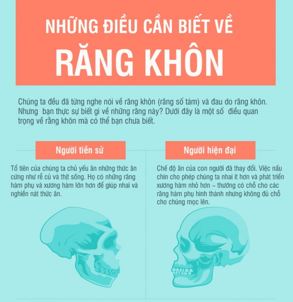 (Infographic) Những điều cần biết về răng khôn