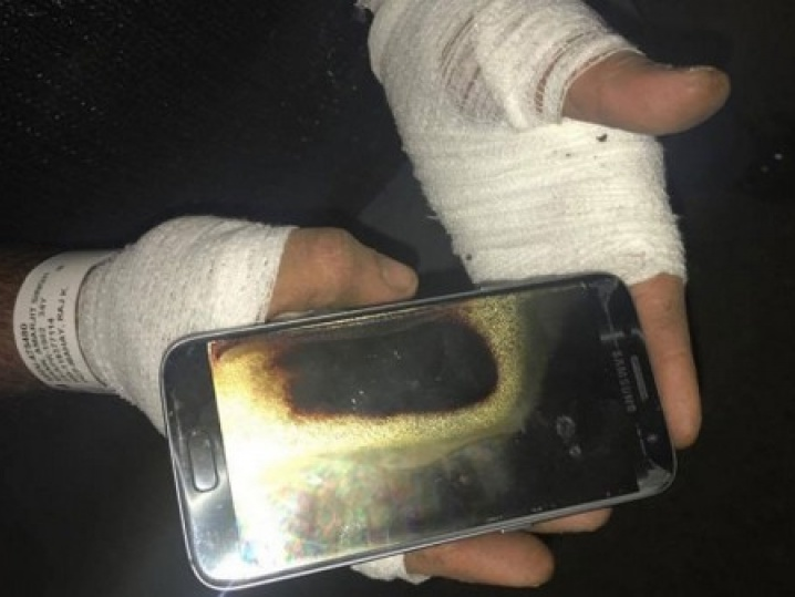 Galaxy S7 phát nổ trên tay gây bỏng khá nặng cho chủ nhân
