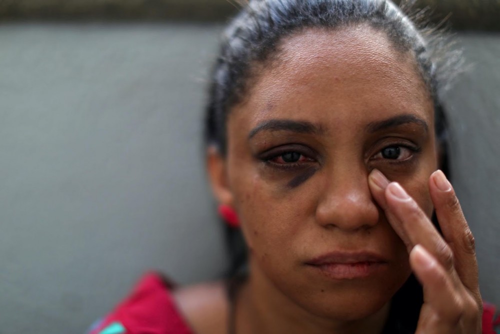 Bùng phát Covid-19: Phụ nữ Brazil hứng chịu bạo lực gia đình