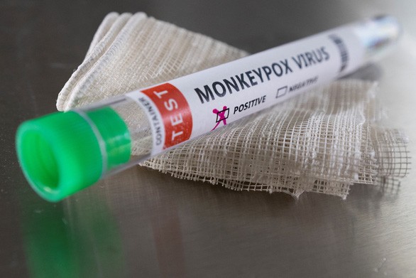 Đậu mùa khỉ có thể được chẩn đoán bằng xét nghiệm PCR - Ảnh: REUTERS