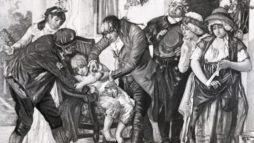 Bác sĩ Edward Jenner tiến hành thí nghiệm trên bệnh nhân James Phipps vào năm 1796. Ảnh: Getty Images 