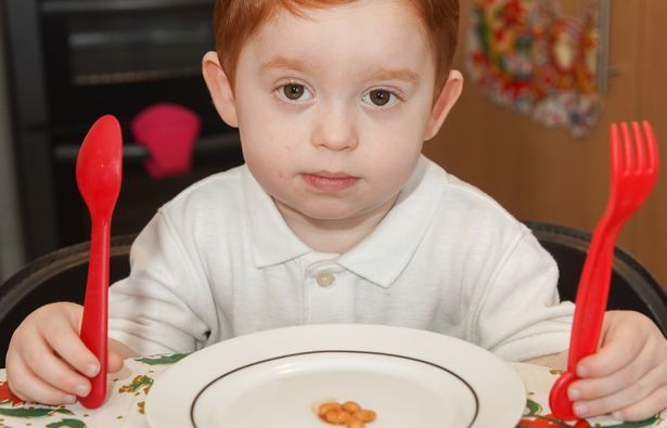 Mắc bệnh lạ, bé trai có thể chết nếu ăn quá 5 hạt đậu mỗi ngày