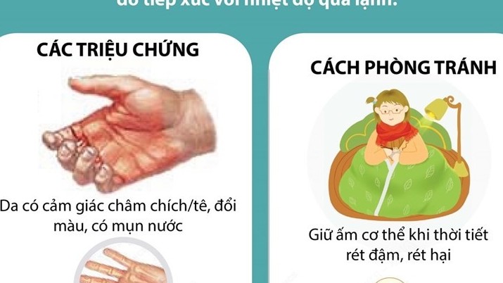 Thời tiết giá rét và cách phòng chống bỏng lạnh