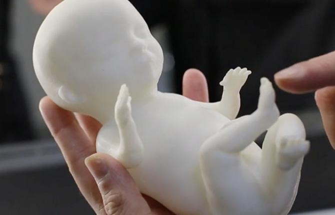 Công nghệ in 3D đem tới mô hình vô cùng chân thực của thai nhi
