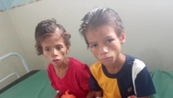 Brazil: Hai bé trai may mắn sống sót sau 4 tuần lạc trong rừng