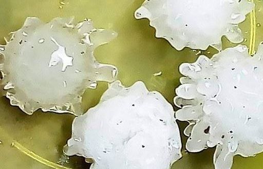 Nhà khoa học giải thích lý do xuất hiện những viên mưa đá có hình virus corona