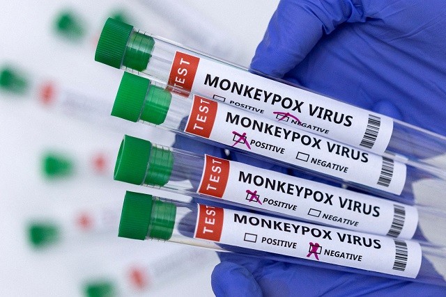 Bệnh đậu mùa khỉ: Mỹ gia tăng ca mắc; Anh cảnh báo lây nhiễm
