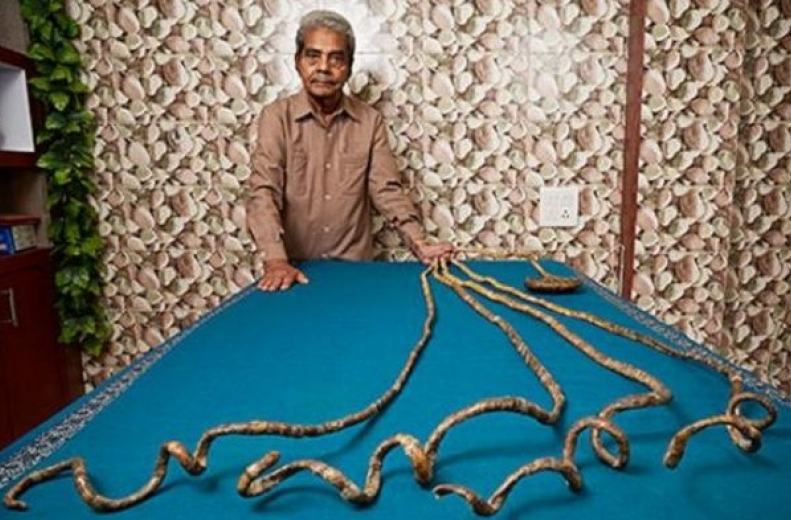 Bộ móng tay dài nhất thế giới cuối cùng đã bị cắt - sau 66 năm