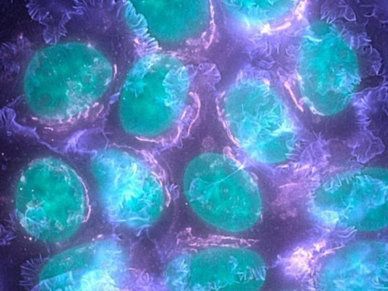 Mỹ lần đầu cấp phép ứng dụng công nghệ biến đổi gene trị ung thư