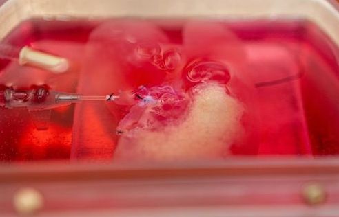 Lần đầu tiên trên thế giới in 3D thành công lá gan người có đầy đủ chức năng sống