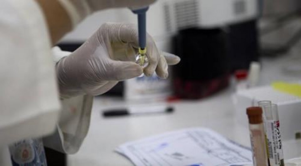 phat hien khang the de san xuat vaccine phong virus zika