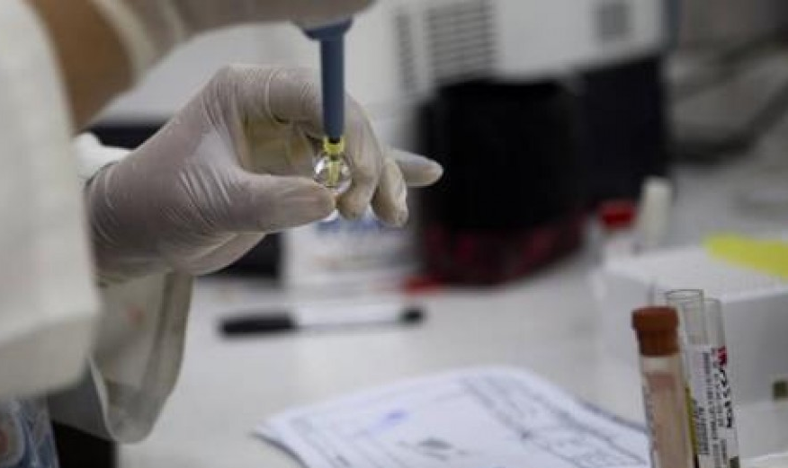 Phát hiện kháng thể để sản xuất vaccine phòng virus Zika
