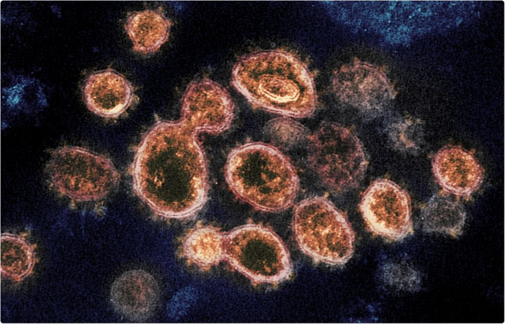 Biến thể mới của virus SARS-CoV-2 gây bệnh Covid-19 mới xuất hiện tại Anh có thể không quá nguy hiểm. (Nguồn: NIAID)
