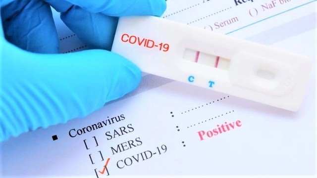 Rất ít khả năng 2 lần nhiễm Covid-19 trong một tháng