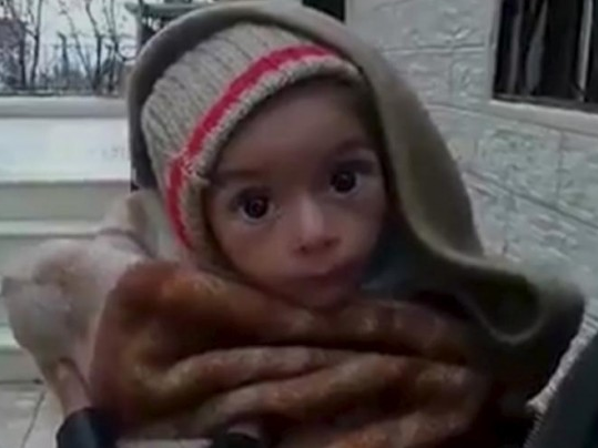 UNICEF cảnh báo tình trạng suy dinh dưỡng nghiêm trọng của trẻ em Madaya
