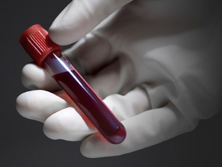 Phát triển dụng cụ phát hiện nhanh ung thư bằng mẫu máu