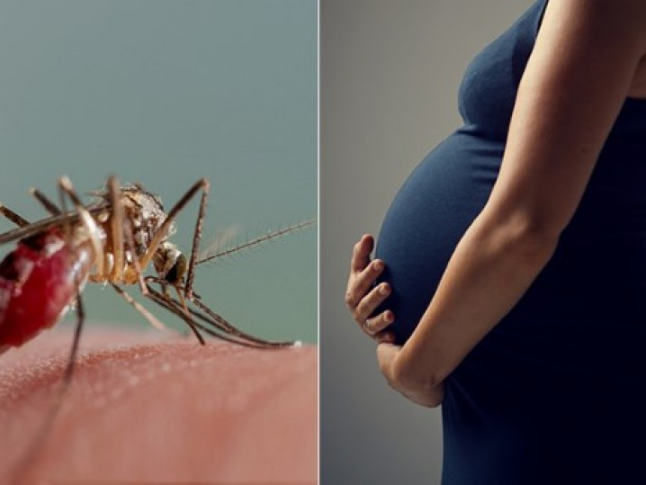 Mỹ ghi nhận trường hợp đầu tiên trẻ sơ sinh tử vong do virus Zika