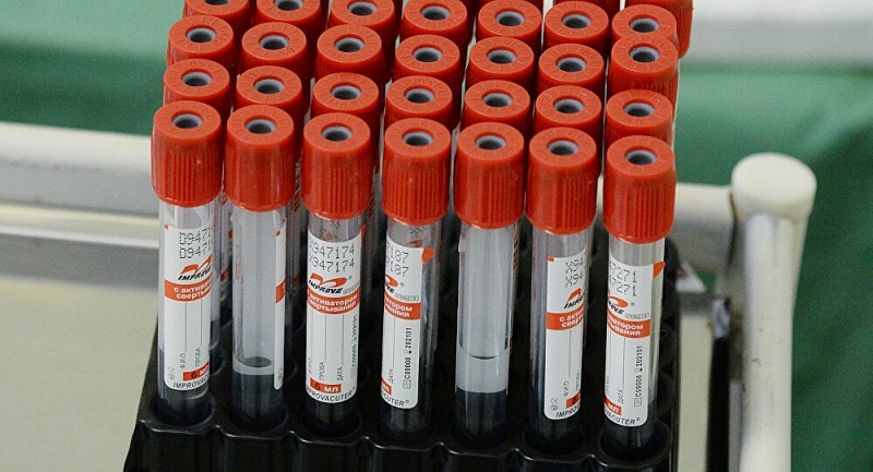 Chuyên gia miễn dịch học xóa tan quan niệm sai lầm về kháng thể đối với virus corona Chuyên gia miễn dịch học xóa tan quan niệm sai lầm về kháng thể đối với virus corona