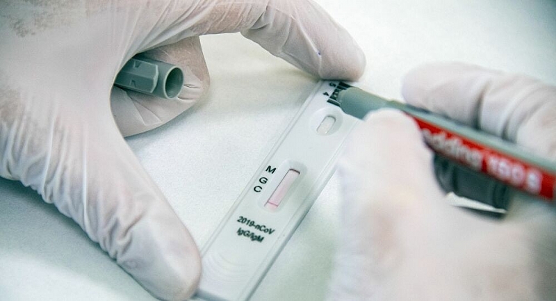 Nga phát triển dụng cụ đo kháng thể đối với coronavirus tại nhà