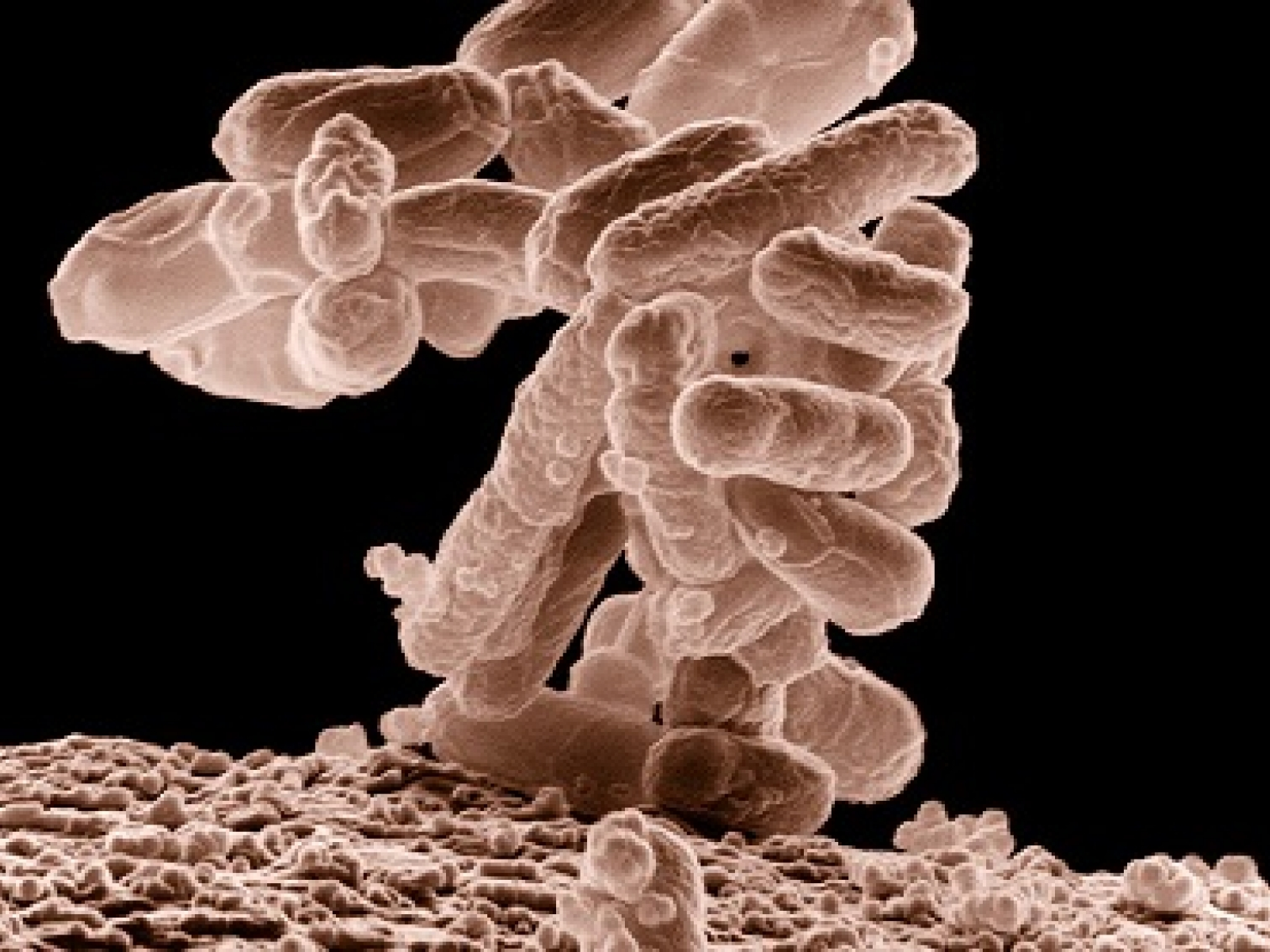 Xuất hiện siêu vi khuẩn có thể gây đại dịch toàn cầu?