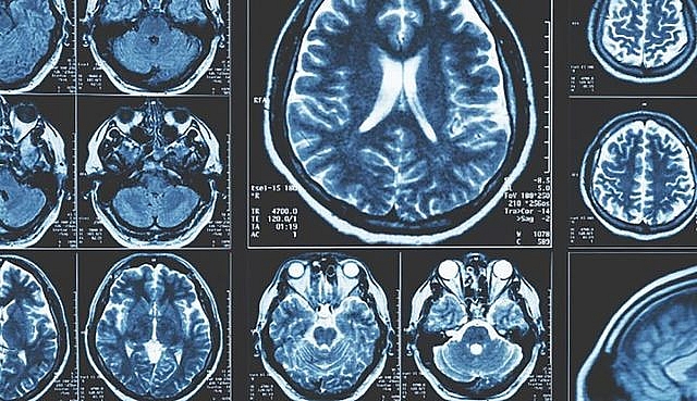 1238-parkinsondocx-1561250394228